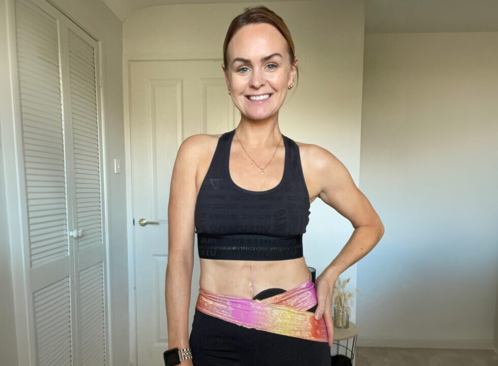 Taking time for you with a stoma