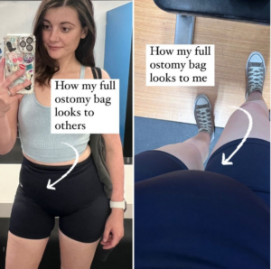 Amy, confidently, in a black sports bra and shorts proudly showcases her fit physique.
