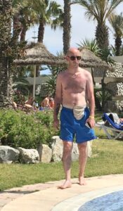 Chris, wearing blue shorts, stands next to a pool, soaking up the sun without a shirt on and his stoma bag out!