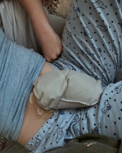 Amy snaps a picture of her full ostomy bag, while relaxing in pyjamas.