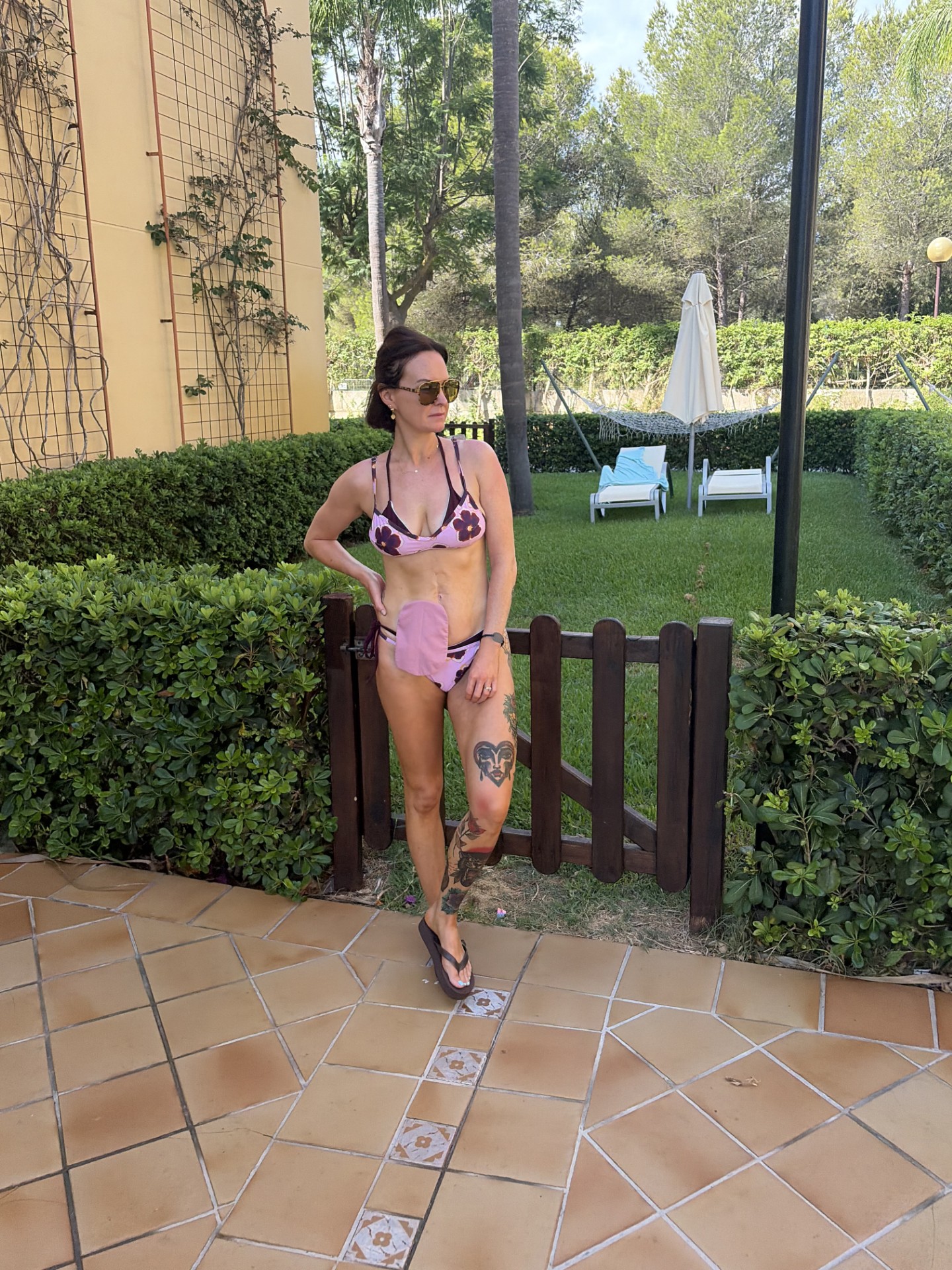 A woman posing in front of a brown gate and green bushes, where a pink and black bikini with matching stoma bag